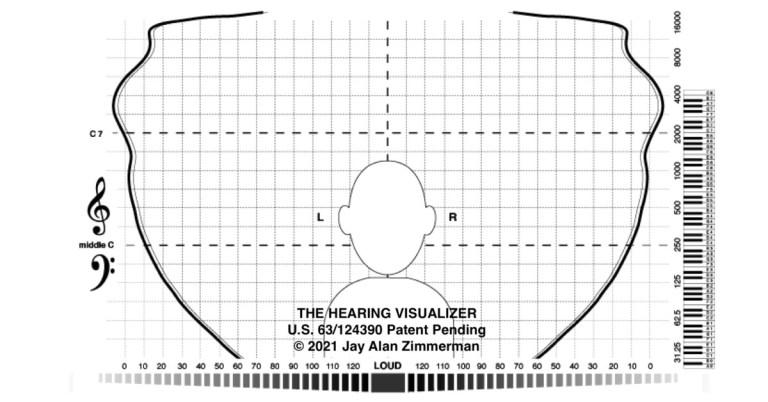 聽力具現圖範例：典型的「正常聽力者」