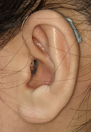 Jedi 佩戴耳內接收器型助聽器的左耳特寫