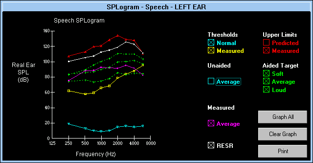 DSL 4.1 軟體的語音實耳反應圖型（SPLogram - Speech）視窗