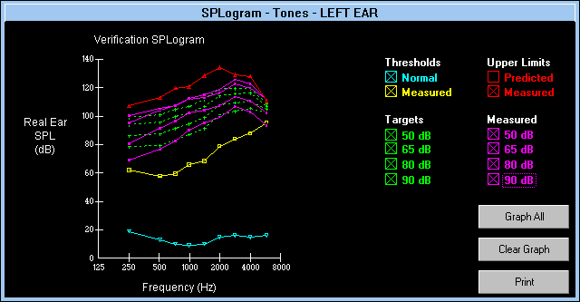 DSL 4.1 軟體的純音實耳反應圖型（SPLogram - Tones）視窗