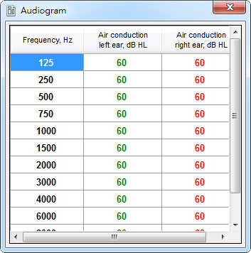 CAM2B v4: Audiogram (table with data)